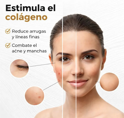 Máscara LED Facial – Elimina Manchas, Acné y Arrugas desde Casa